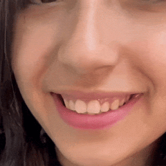 SMILEFIT PRO – REGULOWANY ZESTAW ZĘBÓW DLA IDEALNEGO UŚMIECHU